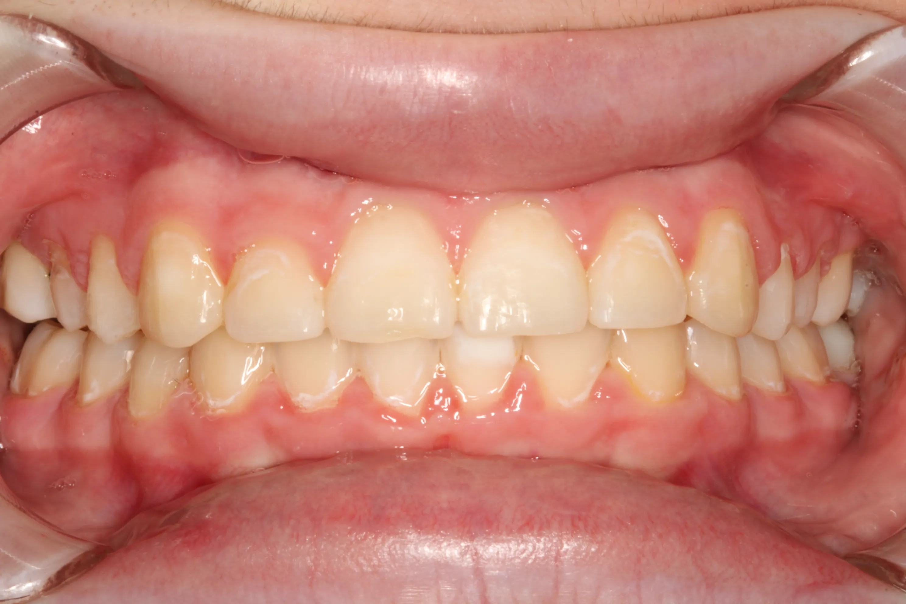 smile-gallery gallery